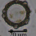 Today at the microscope: Diatom and Coccolithophore BFFs
