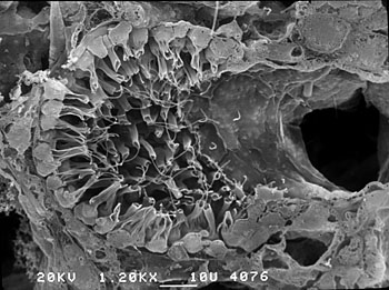 A choanocyte chamber, as seen by a scanning electron microscope