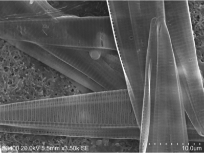 Pennate diatoms genus Pseudo-nitzschia photographed by Sara Tanner Many species produce domoic acid, a neurotoxin which is responsible for Amnesiac Shellfish Poisoning.